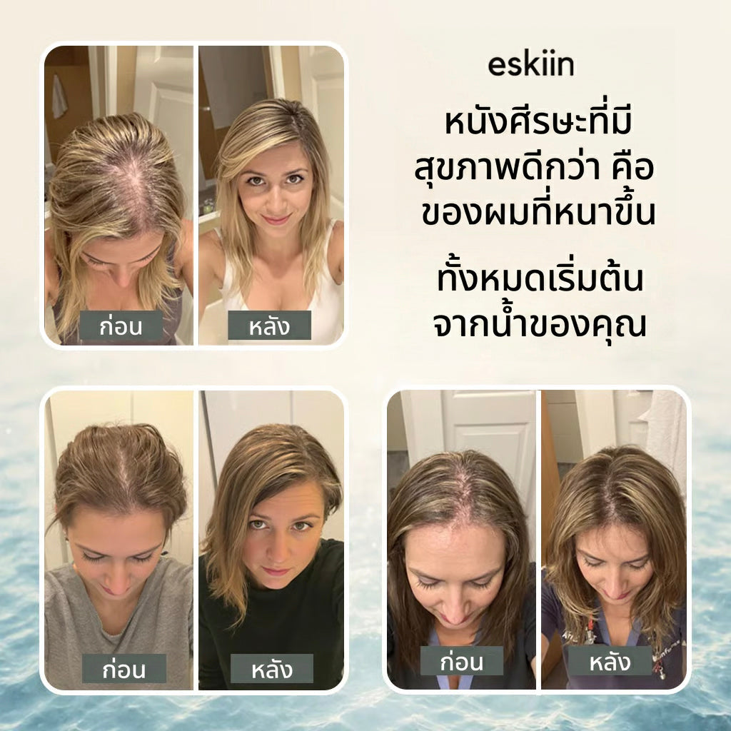 หัวฝักบัวกรองน้ำ PureFlow (COD)